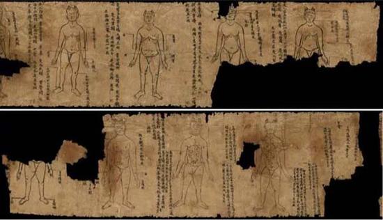 灸法图 敦煌藏经洞出土